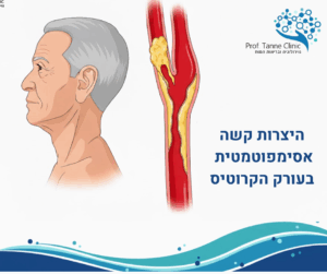 היצרות אסימפטומטית בעורק הקרוטיס והסיכון לשבץ מוחי